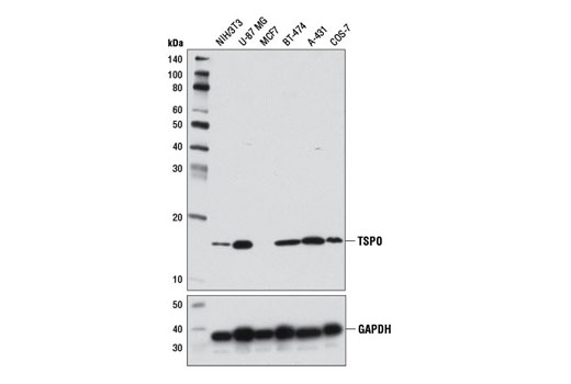 Western blot analysis of extacts from various cell lines using TSPO Antibody (upper) or GAPDH (D16H11) XP® Rabbit mAb #5174 (lower).