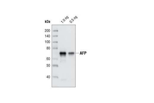  Western blot analysis of recombinant AFP, using AFP Antibody.