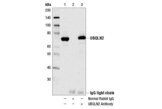 Immunoprecipitation of UBQLN2 from 293T cell extracts using Normal Rabbit IgG #2729 (lane 2) or UBQLN2 Antibody (lane 3). Lane 1 is 10% input. Western blot was performed using UBQLN2 Antibody.