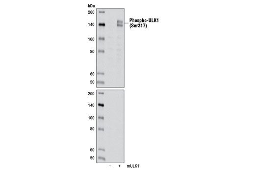 Western blot analysis of extracts from 293T cells, mock transfected or transfected with a construct overexpressing mouse ULK1 using Phospho-ULK1 (Ser317) Antibody. Membranes were untreated (upper) or treated with Calf Intestinal Phosphatase (CIP) (lower) to demonstrate phospho-specificity.