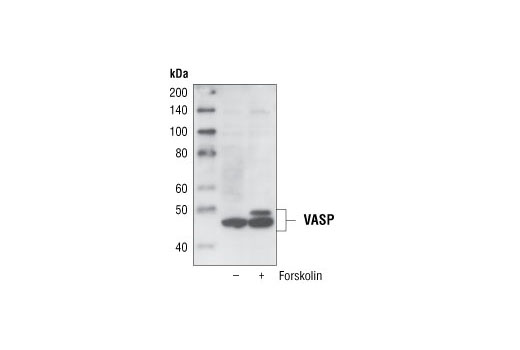 Western blot analysis of extracts from HeLa cells, untreated or forskolin-treated (10 µM, 15 minutes), using VASP (A290) Antibody.