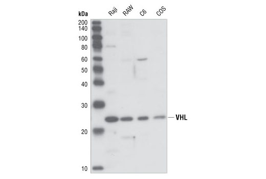 Western blot analysis of lysates from various cell lines using VHL antibody.