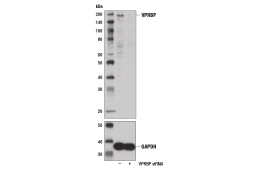 Western blot analysis of extracts from 293T cells, transfected with 100 nM SignalSilence® Control siRNA (Unconjugated) #6568 (-) or SignalSilence® VPRBP siRNA l #14010 (+), using VPRBP Antibody (upper) and GAPDH (D16H11) XP® Rabbit mAb #5174 (lower). The VPRBP Antibody confirms silencing of VPRBP expression, while the GAPDH (D16H11) XP® Rabbit mAb is used as a loading control.