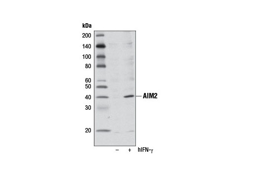  Western blot analysis of extracts from HL-60 cells, serum-starved and either untreated (-) or treated overnight with Human Interferon-γ (hIFN-γ) #8901 (100 ng/ml), using AIM2 Antibody.