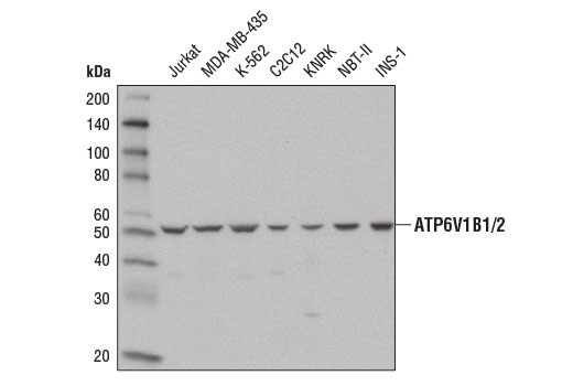Western blot analysis of extracts from various cell lines using ATP6V1B1/2 Antibody.