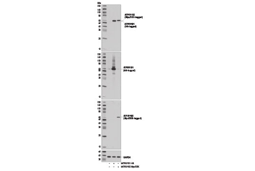 Western blot analysis of extracts from 293 cells, mock transfected (-) or transfected with a construct expressing either HA-tagged full-length human ATP6V1B1 protein (hATP6V1B1-HA; +) or Myc/DDK-tagged full-length human ATP6V1B2 protein (hATP6V1B2-Myc/DDK; +), using ATP6V1B1/2 Antibody (upper), HA-Tag (C29F4) Rabbit mAb #3724 (upper middle), Myc-Tag (71D10) Rabbit mAb #2278 (lower middle), and GAPDH (D16H11) XP® Rabbit mAb #5174 (lower).