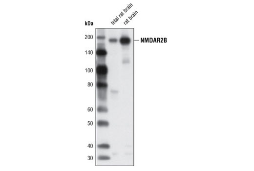 Western blot analysis of extracts from fetal rat brain and rat brain using NMDAR2B (N59/36.1) Mouse mAb.