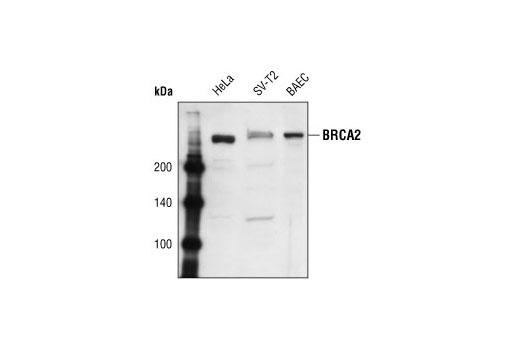 Western blot analysis of extracts from human (HeLa), murine (SV-T2) and bovine (BAEC) cells using BRCA2 Antibody.