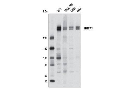 Western blot analysis of extracts from various cell lines using BRCA1 (D54A8) Rabbit mAb.