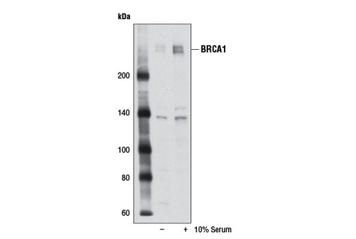 Western blot analysis of extracts from MCF7 cells, deprived of serum for 24 hr and either untreated (-) or serum-treated for 18 hr (+), using BRCA1 (D54A8) Rabbit mAb.
