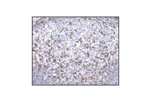 Immunohistochemical analysis of paraffin-embedded human tonsil using CD45 (136-4B5) Mouse mAb.