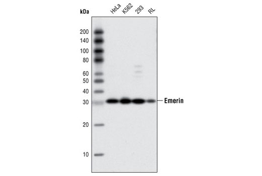 Western blot analysis of extracts from various cell types using Emerin (A212) Antibody.