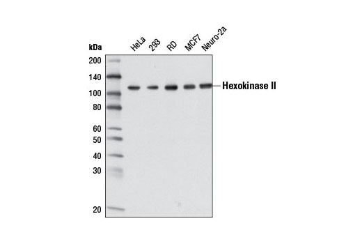 Western blot analysis of extracts from various cell lines using Hexokinase II (3D7) Mouse mAb.