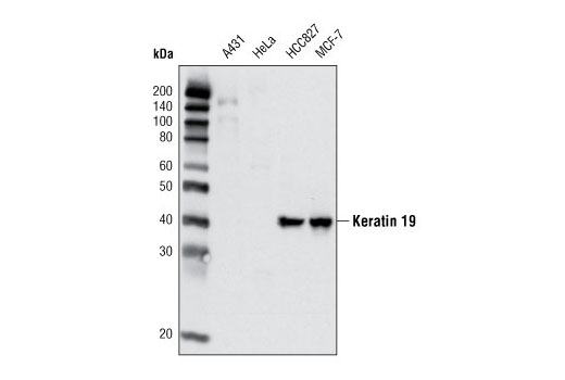 Western blot analysis of extracts of various cell lines using Keratin 19 Antibody. Note that HeLa and A431 are negative for Keratin 19, as expected.