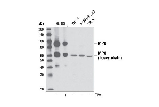 Western blot analysis of extracts from various cell lines using Myeloperoxidase (P733) Antibody. HL-60 cells were treated with TPA #9905 (200 nM, overnight).