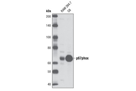 Western blot analysis of extracts from RAW 264.7 and C6 cells using p67phox Antibody.