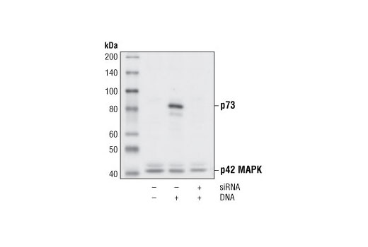 Western blot analysis of extracts from HeLa cells untransfected (lane 1) or transfected with p73 DNA (lanes 2 and 3). Overexpression of p73 can be specifically blocked by co-transfection with p73 siRNA #6371 (lane 3). p73 was detected using p73 Antibody and p42 was detected using p42 MAPK Antibody #9108. The p73 Antibody confirms silencing of exogenous p73 expression and the p42 MAPK Antibody is used to control for loading and siRNA specificity.