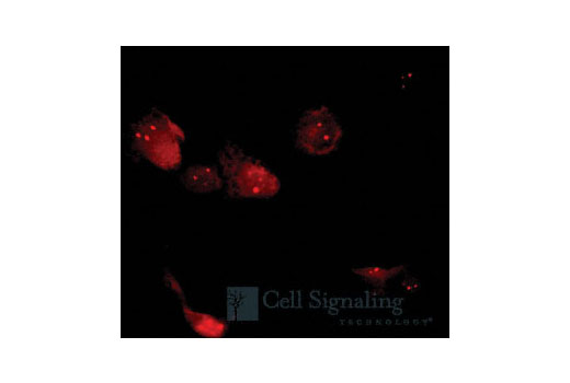 Immunofluorescent analysis of M059J cells, showing localization primarily in the nucleoli, using Rad52 Antibody.