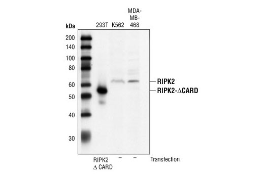 Western blot analysis of extracts from 293T cells transfected with RIP2-ΔCARD, and extracts from K562 and MDA-MB-468 cells, using RIP2 Antibody.