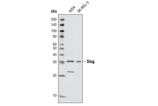 Western blot analysis of extracts from A204 and SK-MEL-5 cells using Slug (L40C6) Mouse mAb.