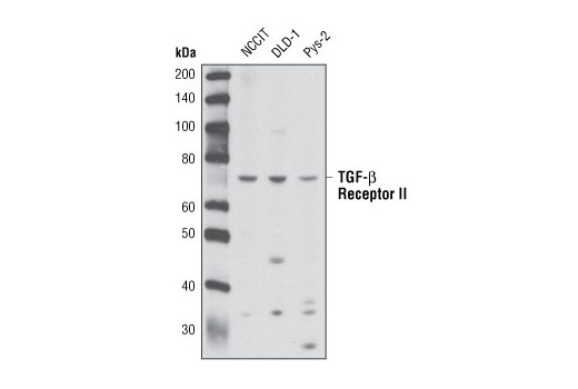 Western blot analysis of extracts from NCCIT, DLD-1 and Pys-2 cells using TGF-β Receptor II (K105) Antibody.