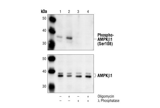  Western blot analysis of extracts from C2C12 cells, untreated (lanes 1,3) or oligomycin-treated (lanes 2,4), using Phospho-AMPKβ1 (Ser108) Antibody (upper) or AMPKβ1 Antibody #4182 (lower). Cell lysates were treated with λ phosphatase in lanes 3 and 4 to demonstrate the phospho-specificity of Phospho-AMPKβ1 (Ser108) Antibody.