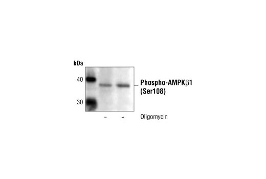 Immunoprecipitation of phosphorylated AMPKβ1 from untreated or oligomycin-treated C2C12 cells using Phospho-AMPKβ1 (Ser108) Antibody, followed by western blot analysis using the same antibody.