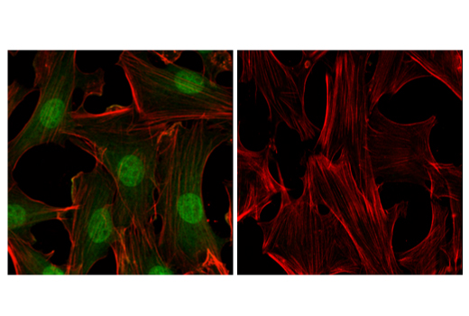 Confocal immunofluorescent analysis of C2C12 cells, treated with PDBu (left, 100 nM for 15 min) or U0126 #9903 (right, 10 uM for 2hr), using Phospho-p44/42 MAPK (Erk1/2) (Thr202/Tyr204) (D13.14.4E) XP® Rabbit mAb (Alexa Fluor® 488 Conjugate) (green) and β-Actin (8H10D10) Mouse mAb #3700 (red).