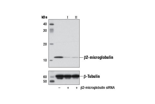 Western blot analysis of extracts from HeLa cells, transfected with 100 nM SignalSilence® Control siRNA (Unconjugated) #6568 (-), SignalSilence® β2-microglobulin siRNA I #7759 (+), or SignalSilence® β2-microglobulin siRNA II #7774 (+), using β2-microglobulin Antibody (upper) or β-Tubulin (9F3) Rabbit mAb #2128 (lower). The β2-microglobulin Antibody confirms silencing of β2-microglobulin expression, while the β-Tubulin (9F3) Rabbit mAb is used as a loading control.