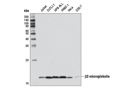 Western blot analysis of extracts from various cell lines using β2-microglobulin Antibody.