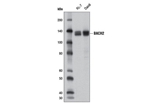 Western blot analysis of extracts from RL-7 and Daudi cells using BACH2 Antibody.