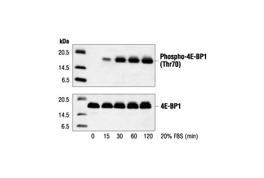 Western blot analysis of extracts from 293 cells, untreated or treated with 20% FBS for the indicated number of minutes, using Phospho-4E-BP1 (Thr70) Antibody (upper) or 4E-BP1 Antibody #9452 (lower).