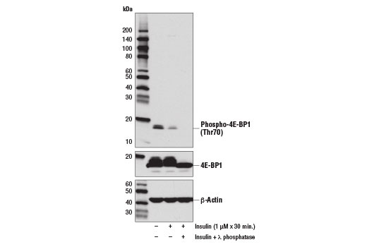 Western blot analysis of extracts from serum starved HeLa cells, untreated (-), insulin-treated (1 μM, 30 min; +), or insulin and λ phosphatase-treated (+), using Phospho-4E-BP1 (Thr70) (D7F6I) Rabbit mAb (upper), 4E-BP1 (53H11) Rabbit mAb #9644 (middle), and β-Actin (D6A8) Rabbit mAb #8457 (lower).