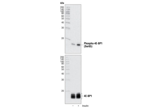 Western blot analysis of extracts from 293 cells using 4E-BP1 Antibody #9644 (lower) and Phospho-4E-BP1 (Ser65) Antibody #9451 (upper). The cells were starved for 24 hours in serum-free medium and underwent a 1 hour amino acid deprivation. Amino acids were replenished for 1 hour. Cells were then either untreated (-) or treated with 100 nM insulin (+) for 30 minutes.