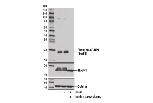 Western blot analysis of extracts from serum starved HeLa cells, untreated (-), insulin-treated (1 μM, 30 min; +), or insulin and λ phosphatase-treated (+), using Phospho-4E-BP1 (Ser65) (D9G1Q) Rabbit mAb (upper), 4E-BP1 (53H11) Rabbit mAb #9644 (middle), and β-Actin (D6A8) Rabbit mAb #8457 (lower).