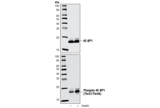Western blot analysis of extracts from 293T cells using 4E-BP1 Antibody #9452 (upper) and Phospho-4E-BP1 (Thr37/46) Antibody (lower). The cells were starved for 24 hours in serum-free medium and underwent a 1 hour amino acid deprivation. Amino acids were replenished for 1 hour. Cells were then either untreated (-) or treated with 100 nM insulin (+) for 30 minutes.