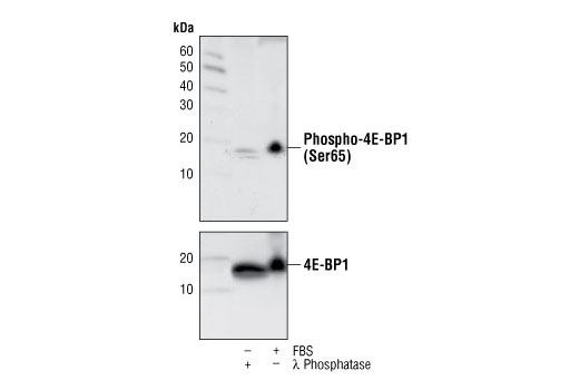 Western blot analysis of extracts from 293 cells, lambda phosphatase treated, or treated with 20% FBS, using Phospho-4E-BP1 (Ser65) (174A9) Rabbit mAb (upper) or 4E-BP1 Antibody #9452 (lower).