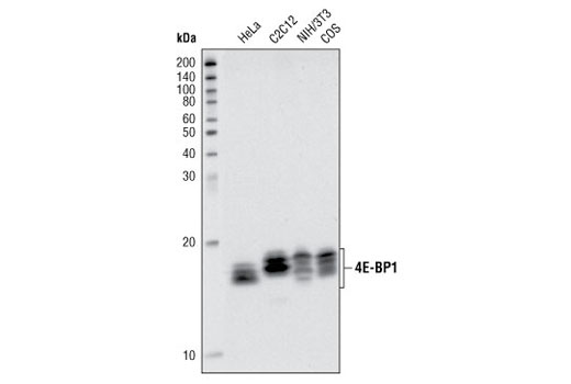 Western blot analysis of extracts from various cell lines using 4E-BP1 Antibody.