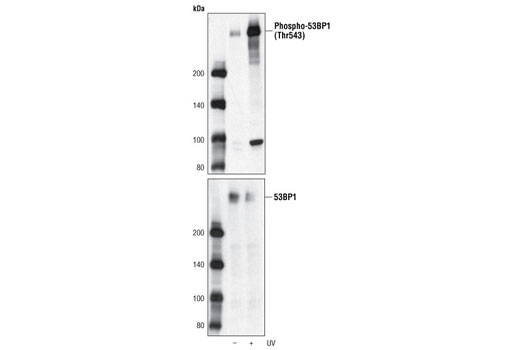 Western blot analysis of extracts from M059K cells, untreated or UV-treated, using Phospho-53BP1 (Thr543) Antibody (upper) or 53BP1 Antibody #4937 (lower).