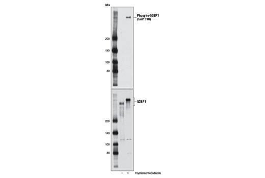 Western blot analysis of extracts from HeLa cells, untreated (-) or synchronized in mitosis by thymidine block and release into nocodazole (+), using Phospho-53BP1 (Ser1618) (D4H11) Rabbit mAb (upper) or 53BP1 (P550) Antibody #4908 (lower).