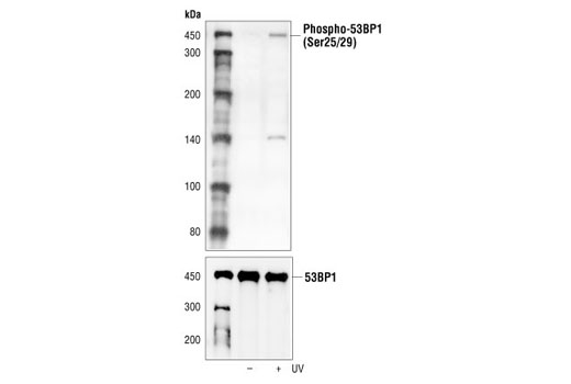 Western blot analysis of extracts from 293 cells, untreated or UV-treated (50 mJ for 2 hours), using Phospho-53BP1 (Ser25/29) Antibody (upper) or 53BP1 Antibody #4937 (lower).