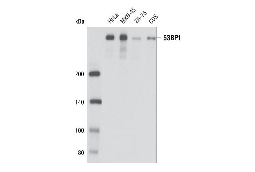Western blot analysis of extracts from various cell types using 53BP1 (P550) Antibody.