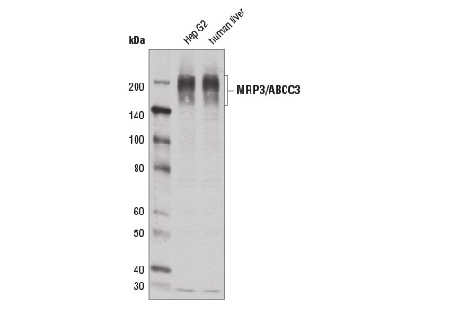 Western blot analysis of extracts from Hep G2 cells and human liver using MRP3/ABCC3 (D1W1P) Rabbit mAb.