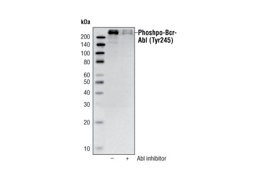 Western blot analysis of extracts from K562 cells, untreated or treated with an Abl inhibitor, using Phospho-c-Abl (Tyr245) Antibody.
