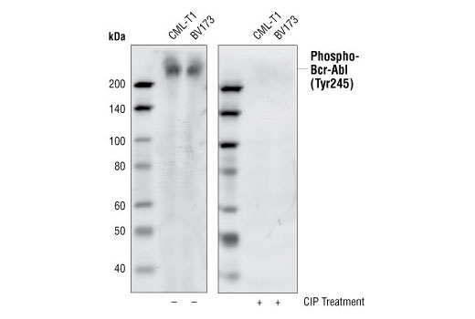 Western blot analysis of CML-T1 and BV173 cell lysates, using Phospho-c-Abl (Tyr245) (73E5) Rabbit mAb. The phospho-specificity of the antibody was verified by treating the membrane with (+) (right) or without (-) (left) calf intestinal phosphatase (CIP) after Western transfer.
