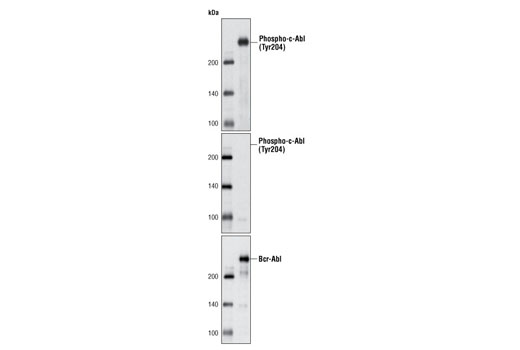 Western blot analysis of extracts from CML-T1 leukemic cells using Phospho-c-Abl (Tyr204) (C42B5) Rabbit mAb (upper and middle) or c-Abl Antibody #2862 (lower). The phospho-specificity of this rabbit mAb was verified by treating the membrane with calf intestinal phosphatase (CIP) (middle and lower) before antibody probing.