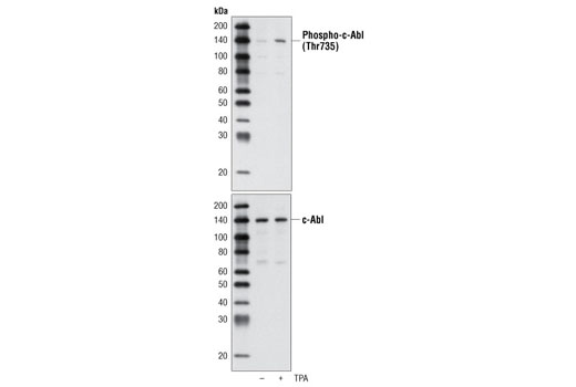 Western blot analysis of extracts from HeLa cells, untreated or TPA-treated (200 nM), using Phospho-c-Abl (Thr735) Antibody (upper) or c-Abl Antibody #2862 (lower).