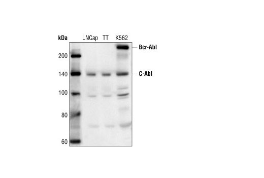 Western blot analysis of extracts from various cell lines, using c-Abl Antibody.