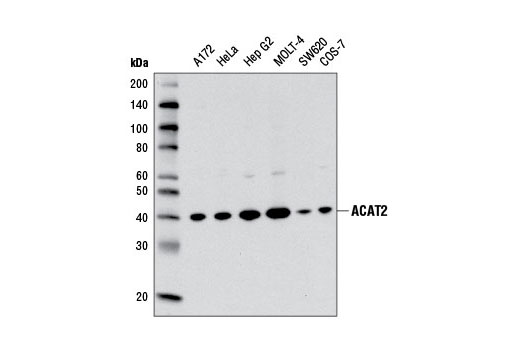 Western blot analysis of extracts from various cell lines using ACAT2 (E1L8V) Rabbit mAb.