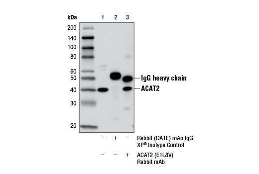 Immunoprecipitation of ACAT2 from Hep G2 cell extracts using Rabbit (DA1E) mAb IgG XP ® Isotype Control #3900 (lane 2) or ACAT2 (E1L8V) Rabbit mAb (lane 3). Lane 1 is 10% input. Western blot analysis was performed using ACAT2 (E1L8V) Rabbit mAb.